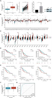 KEAP1 overexpression is correlated with poor prognosis and immune infiltration in liver hepatocellular carcinoma